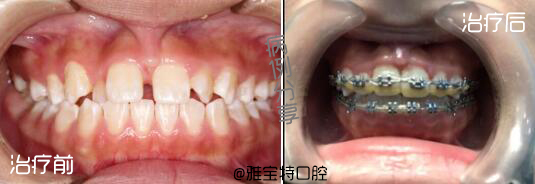 QQ截圖20180306154151.jpg